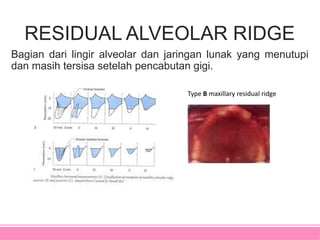Bagian Ridge anatomi landamark denture bearing area.pptx
