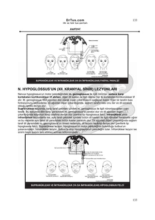 DrTus.com                                                      133
                                          ilk ve tek t us portalı


                                                 ANAT OMĐ




N. HYPOGLOSSUS’UN (XII. KRANYAL SĐNĐR) LEZYONLARI
Nervus hypoglossus’un motor çekirdeğindeki m. genioglossus ile ilgili nöronlar, sadece karşı
korteksten kortikonüklear lif alırken, diğer dil kasları ile ilgili olanlar her iki korteksten kortikonüklear lif
alır. M. genioglossus, dilin ağızdan düz olarak dışarı çıkarılmasını sağlayan kastır. Eğer bir tarafın kası
fonksiyonunu kaybederse, dil ağızdan dışarı çıkarıldığında, sağlam tarafın kası onu iter ve dil paralizik
olduğu tarafa deviye olur.
Supranüklear lezyonda, karşı taraf çekirdek içindeki m. genioglossus ile ilgili nöronlara gelen uyarı
kesilir. Bu durumda dilin karşı yarısındaki m. genioglossus’ta paralizi olur ve dil ağızdan dışarı
çıkarıldığında lezyonun karşı tarafına deviye olur (santral tip hipoglossus felci). Intranüklear yada
infranüklear lezyonlarda ise, aynı taraf çekirdek içindeki bütün dil kasları ile ilgili nöronlar harabiyete uğrar
ve bu nedenle aynı taraf dil yarısındaki bütün kaslar paralizik olur. Dil ağızdan dışarı çıkarıldığında sağlam
taraf dil yarısındaki m. genioglossus’un itmesi nedeniyle, dil lezyon tarafına deviye olur (periferik tip
hipoglossus felci). Supranüklear lezyon, hipoglossus’un motor çekirdeğinin bulunduğu bulbus’un
yukarısındadır. Đntranüklear lezyon, bulbus’ta olup hipoglossus’un çekirdeğini tutar. Đnfranüklear lezyon ise
sinirin beyin sapını terk ettikten sonraki bölümündedir.




                                                                                                            133
 