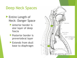 Deep Neck Spaces
 Entire Length of
Neck: Danger Space
 Anterior border is
alar layer of deep
fascia
 Posterior border is
prevertebral layer
 Extends from skull
base to diaphragm
 