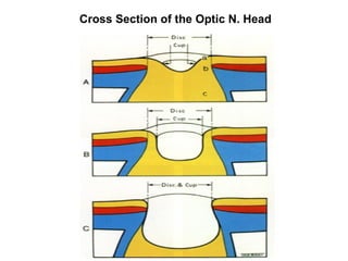 Anatomy of the angle structure (glaucoma) | PPT