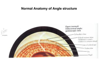 Iridocorneal Angle