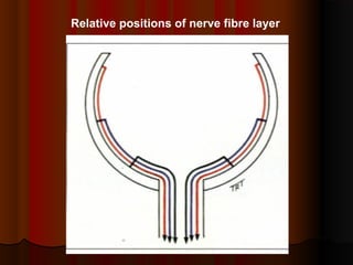 Relative positions of nerve fibre layer

 