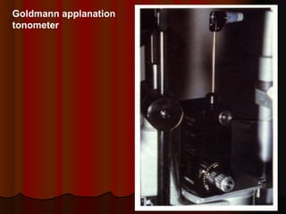 Goldmann applanation
tonometer

 