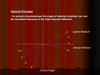 Optical Principal
• In normal circumstances the angle of anterior chamber can not
be visualized because of the total internal reflection

Lighter Medium

a
b
c
d

d
c
b
a
Critical Angle

Denser Medium

 