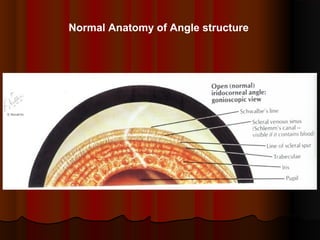 Normal Anatomy of Angle structure

 