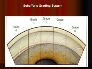 Schaffer’s Grading System

 