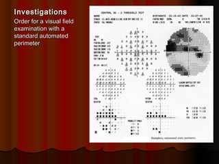 Investigations
Order for a visual field
examination with a
standard automated
perimeter

 