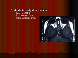 Systemic investigation include
Imaging of CNS
Evaluation of CVS
Haematological profile

 