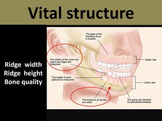 Ridge Joint Examples anatomy.pptx