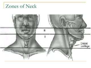 Zones of Neck 