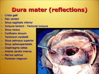 Dura mater (reflections) Crista galli  Falx cerebri  Sinus sagittalis inferior  Incisura tentorii - Tentorial incisure  Sinus rectus  Confluens sinuum  Tentorium cerebelli  Sinus petrosus superior  Sinus sphenoparietalis  Diaphragma sellae  Arteria carotis interna  Nervus opticus  Foramen magnum   
