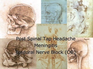 Post Spinal Tap Headache Meningitis Epidural Nerve Block (OB) 