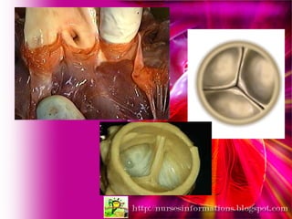 Anatomy Of Cardiovasvular System | PPT