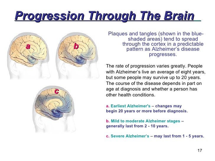 Anatomy Of Human Brain