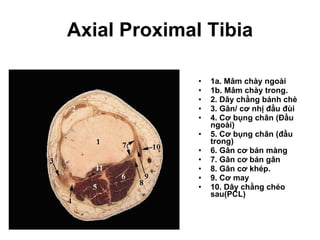 Axial Proximal Tibia 1a. Mâm chày ngoài 1b. Mâm chày trong. 2. Dây chằng bánh chè 3. Gân/ cơ nhị đầu đùi  4. Cơ bụng chân (Đầu ngoài) 5. Cơ bụng chân (đầu trong) 6. Gân cơ bán màng 7. Gân cơ bán gân 8. Gân cơ khép. 9. Cơ may 10. Dây chằng chéo sau(PCL) 
