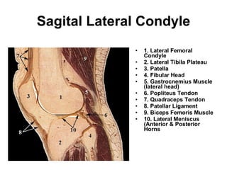 Sagital Lateral Condyle 1. Lateral Femoral Condyle  2. Lateral Tibila Plateau 3. Patella 4. Fibular Head  5. Gastrocnemius Muscle (lateral head) 6. Popliteus Tendon 7. Quadraceps Tendon 8. Patellar Ligament 9. Biceps Femoris Muscle 10. Lateral Meniscus (Anterior & Posterior Horns 
