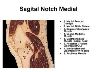 Sagital Notch Medial 1. Medial Femoral Condyle 2. Medial Tibila Plateau  3. Semimembranosus Muscle 4. Vastus Medialis Muscle  5. Gastrocnemius Muscle (medial head) 6. Posterior Cruciate Ligament (PCL)  7. Meniscofemoral Ligament of Wrisberg 8. Popliteus Muscle 