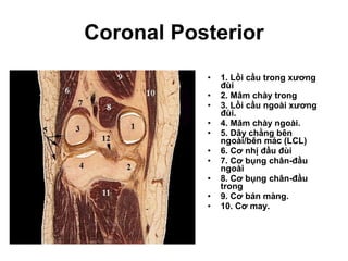 Coronal Posterior 1. Lồi cầu trong xương đùi 2. Mâm chày trong 3. Lồi cầu ngoài xương đùi. 4. Mâm chày ngoài. 5. Dây chằng bên ngoài/bên mác (LCL) 6. Cơ nhị đầu đùi 7. Cơ bụng chân-đầu ngoài 8. Cơ bụng chân-đầu trong 9. Cơ bán màng. 10. Cơ may. 