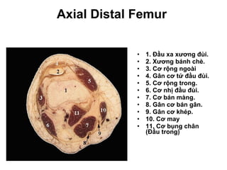 Axial Distal Femur  1. Đầu xa xương đùi. 2. Xương bánh chè. 3. Cơ rộng ngoài 4. Gân cơ tứ đầu đùi. 5. Cơ rộng trong. 6. Cơ nhị đầu đùi. 7. Cơ bán màng. 8. Gân cơ bán gân. 9. Gân cơ khép. 10. Cơ may 11. Cơ bụng chân (Đầu trong)   