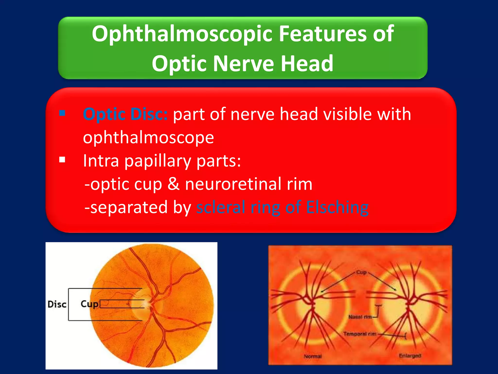 Anatomy of Optic Nerve | PPTX
