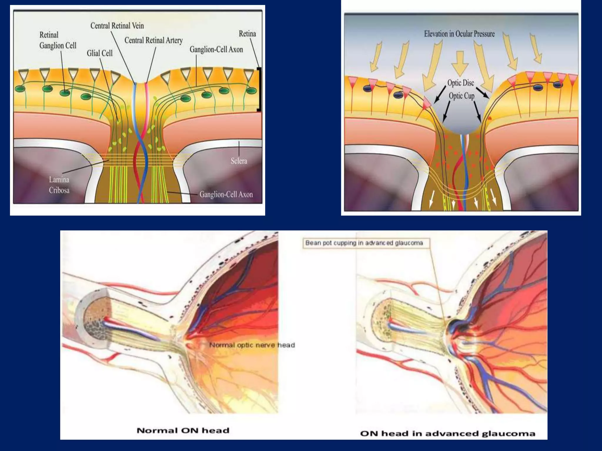 Anatomy of Optic Nerve | PPTX