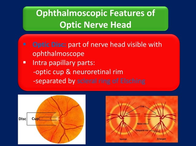 Anatomy of Optic Nerve | PPTX