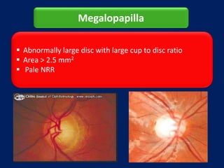 anatomy-of-optic-nerve-pptx