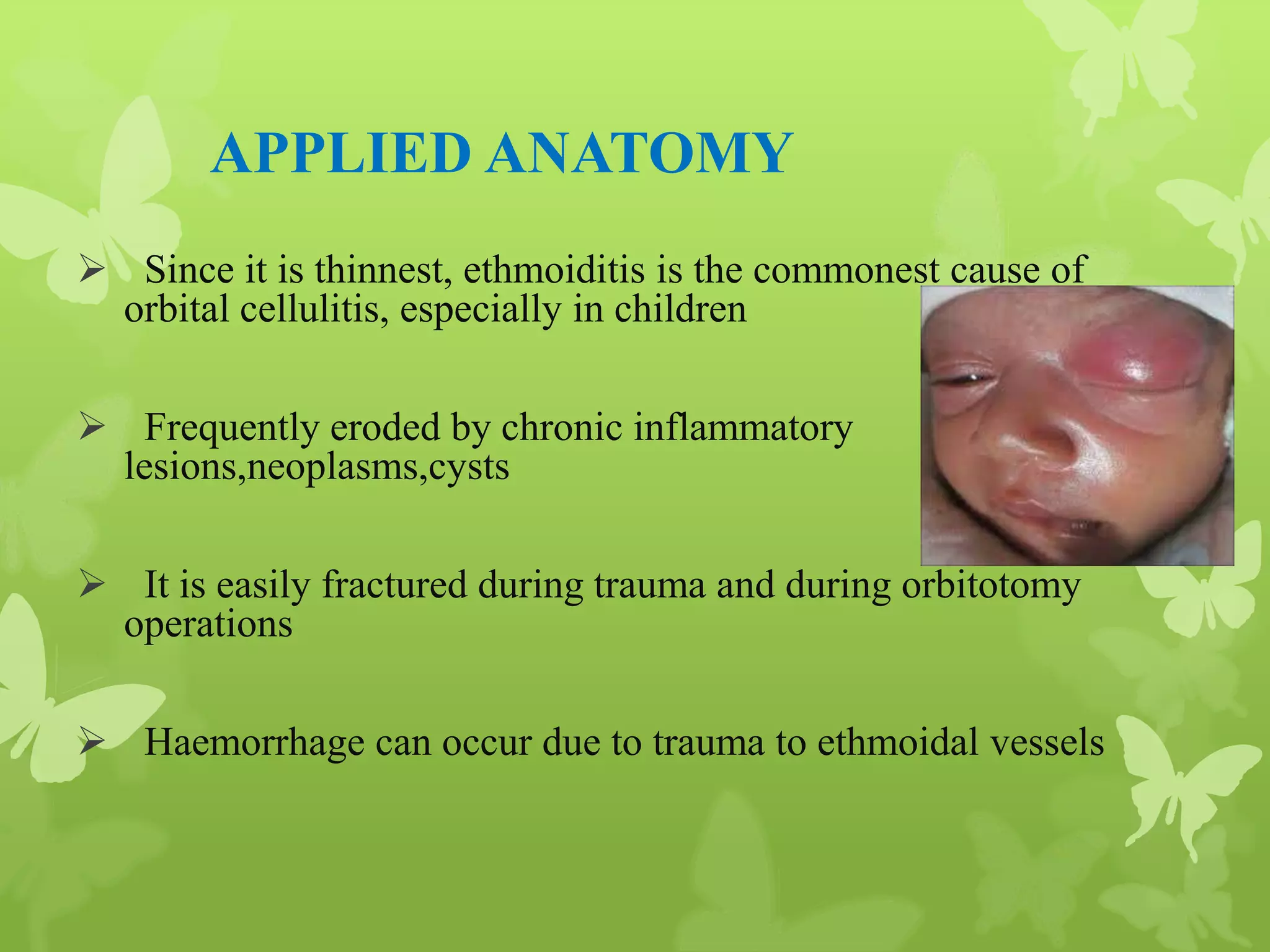 Anatomy of Eye Orbit