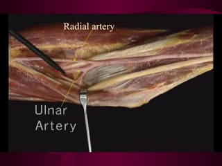 Anatomy of the arm (detailed) | PPT