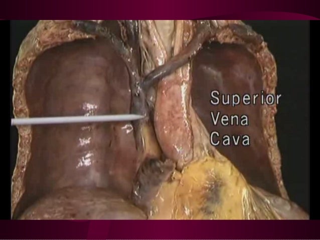 Anatomy of the arm (detailed)