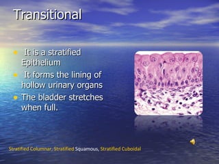 Transitional It is a stratified Epithelium It forms the lining of hollow urinary organs The bladder stretches when full.  Stratified Columnar,  Stratified  Squamous ,  Stratified  Cuboidal 