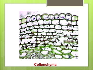 Collenchyma
 