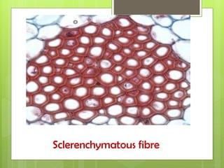 Sclerenchymatous fibre
 