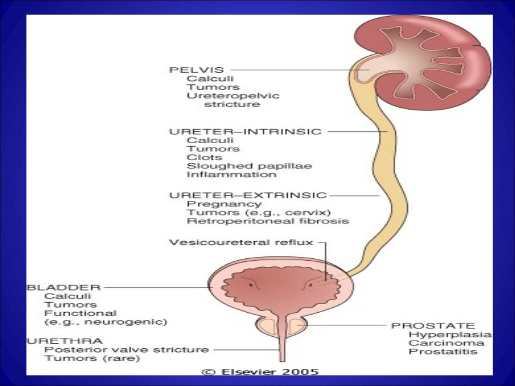Anatomy urinary tract proplems&stons