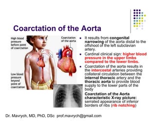 Cardinal Ribs Anatomy 100 Concepts Most Important General Anatomy | PDF