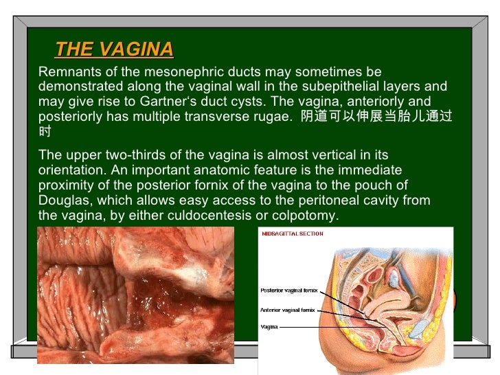 Female Hymen Anatomy Female Hymen Anatomy