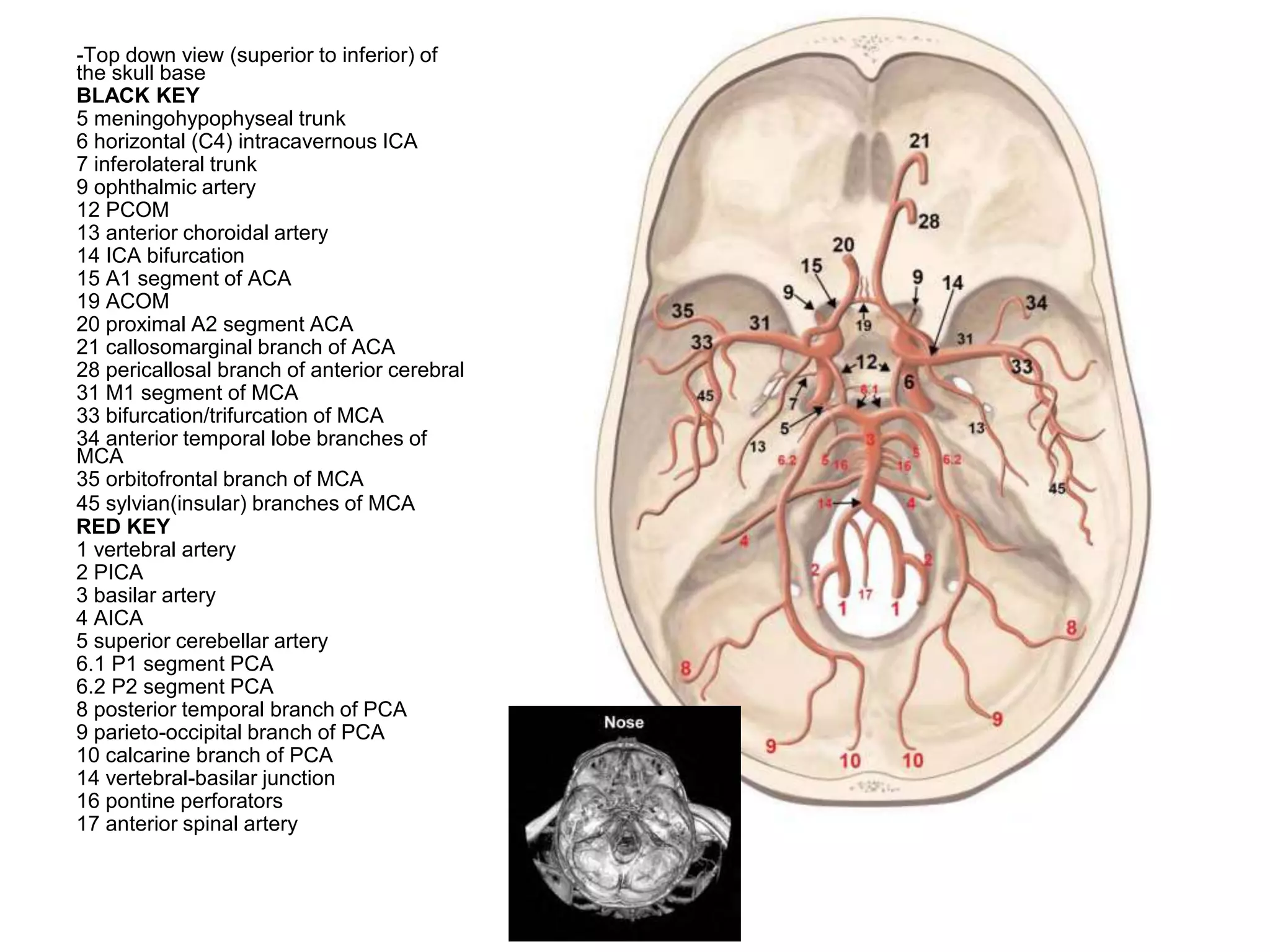 Anatomy of the anterior cerebral artery (ACA) | PPT