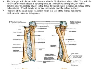 Ulnar variance –
• The relationship of the length of the radius
to the length of the ulna is fairly constant
in individual...