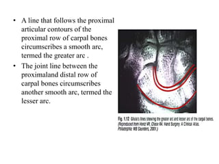 • The nature of the articulations of the distal carpals with one
another, and of the carpal ligament (flexor retinaculum),...