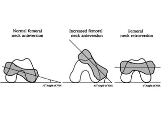 Anatomy and biomechanics of Hip joint | PPTX