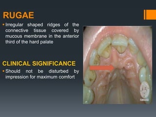 Anatomy and clinical significance of denture bearing areas | PPTX
