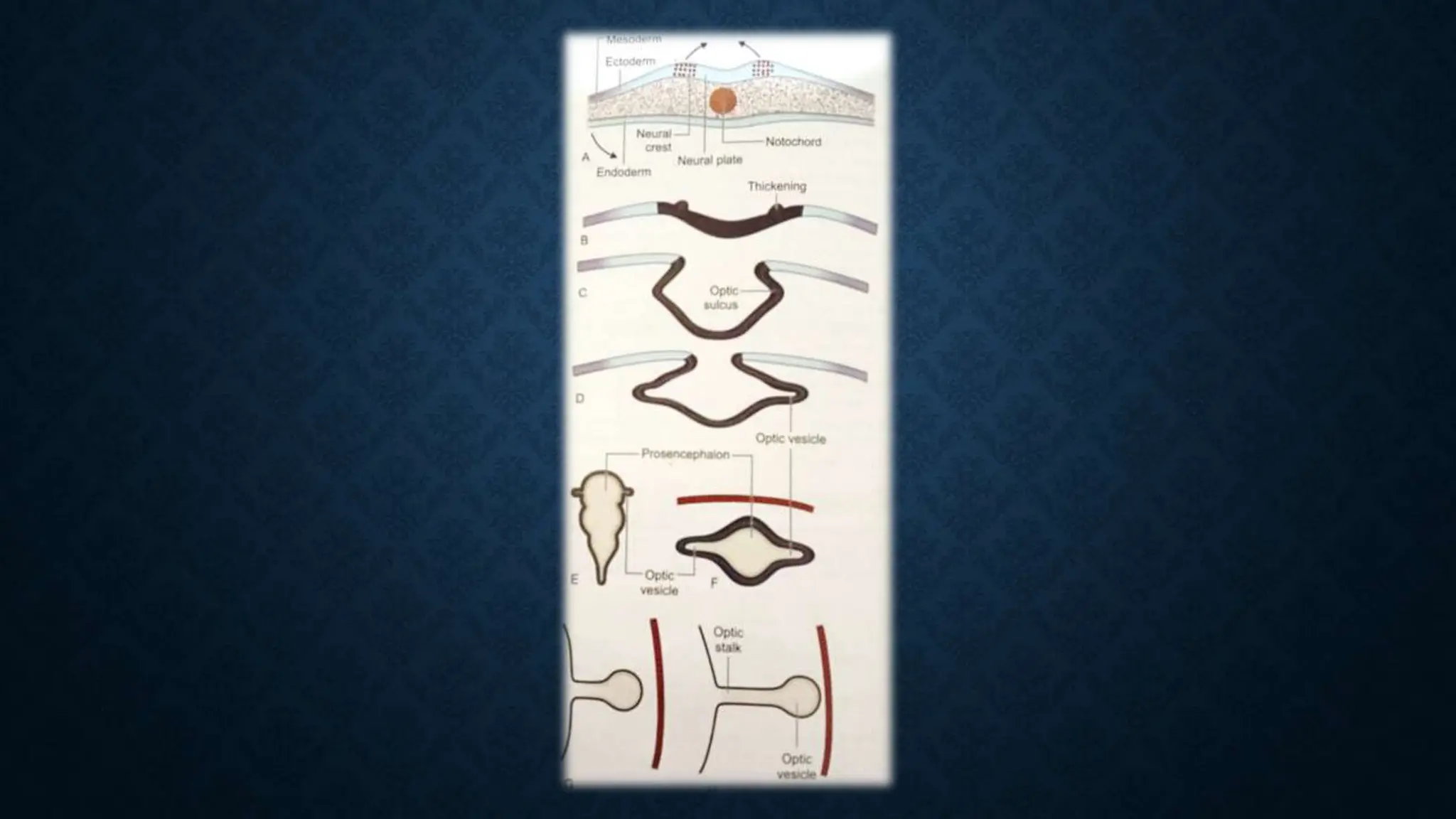 ANATOMY AND DEVELOPMENT OF THE HUMAN EYE. | PPTX