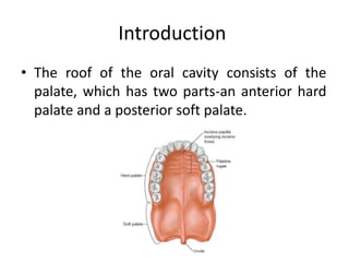 Introduction
• The roof of the oral cavity consists of the
  palate, which has two parts-an anterior hard
  palate and a p...