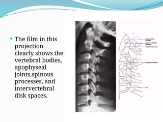 ANATOMY AND IMAGING OF THE SPINE AND TM.pptx