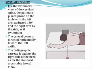 Twining Method Radiography ANATOMY AND IMAGING OF THE SPINE AND TM.pptx