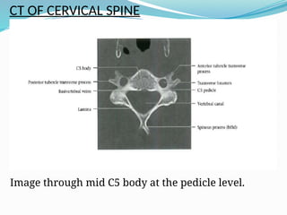 ANATOMY AND IMAGING OF THE SPINE AND TM.pptx