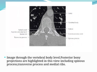 ANATOMY AND IMAGING OF THE SPINE AND TM.pptx