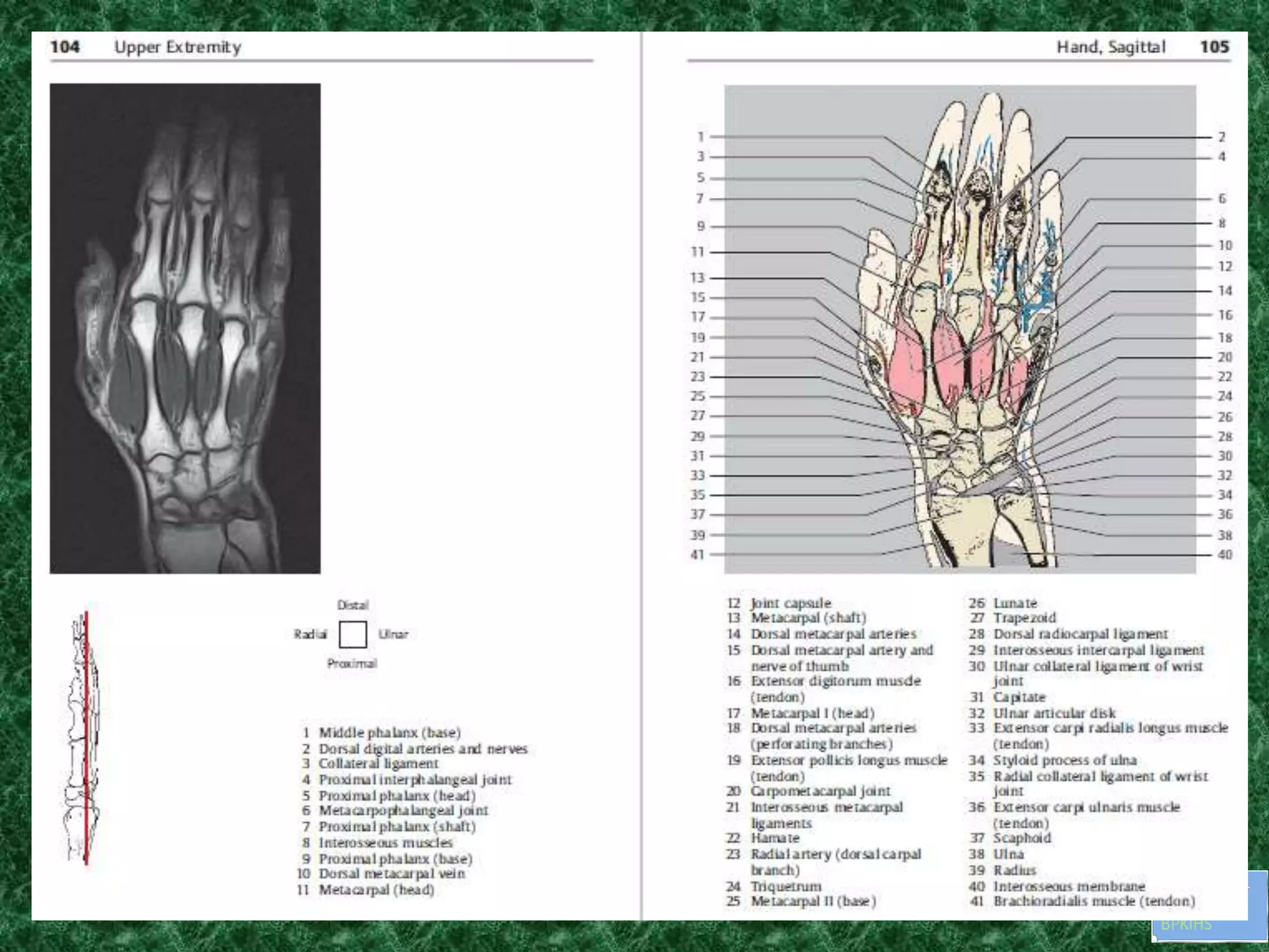 Anatomy and imaging of wrist joint (MRI AND XRAY) | PPTX