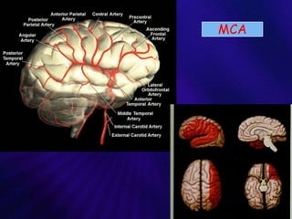 Anatomy and intervention in cerebral vasculature | PPTX