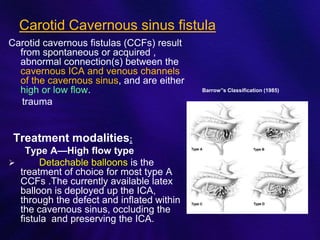 Anatomy and intervention in cerebral vasculature | PPTX